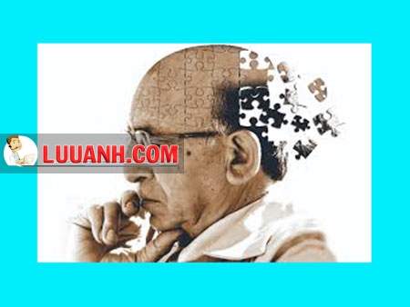 Alzheimer
