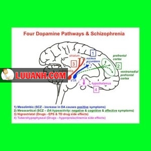 Schizophrenia