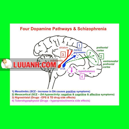 Schizophrenia