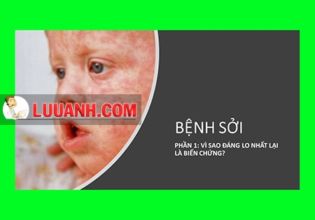 Bệnh Sởi - Đáng Lo Nhất Là Biến Chứng 1 bệnh sởi