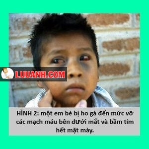 ho gà