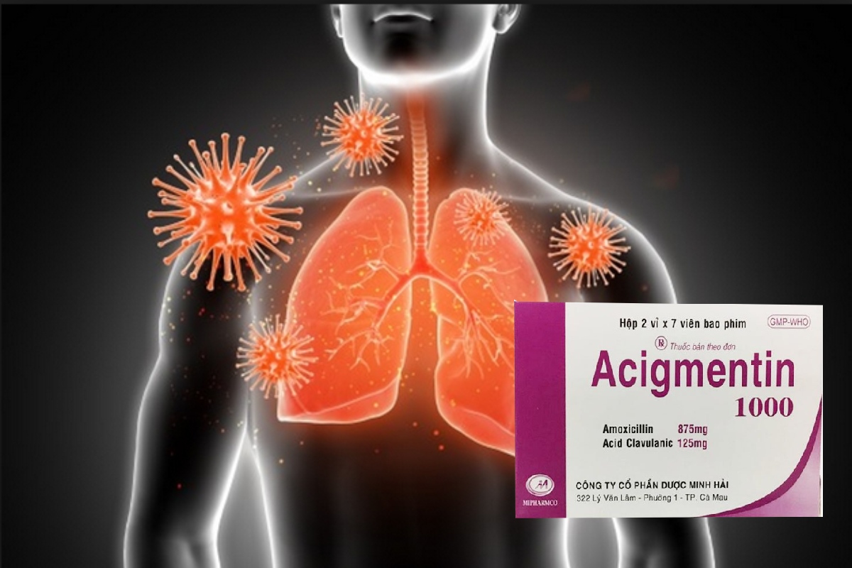 Acigmentin 1000 11 Acigmentin 1000 điều trị nhiễm khuẩn