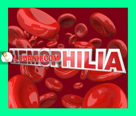 Bệnh máu khó đông