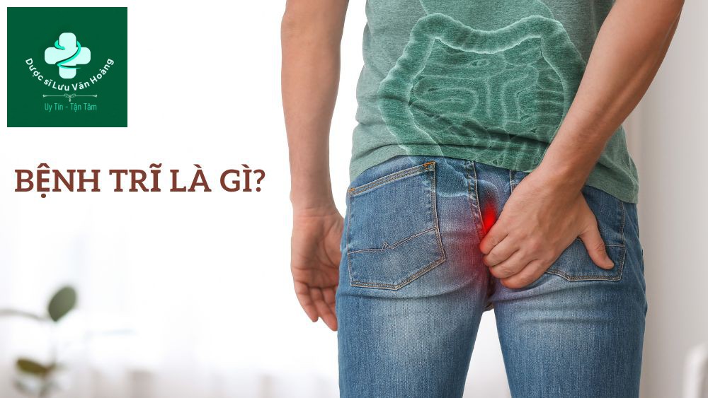 Gợi ý lựa chọn các sản phẩm gel bôi trĩ để giảm thiểu triệu chứng và tiến triển của bệnh trĩ 17 gel-boi-tri-1