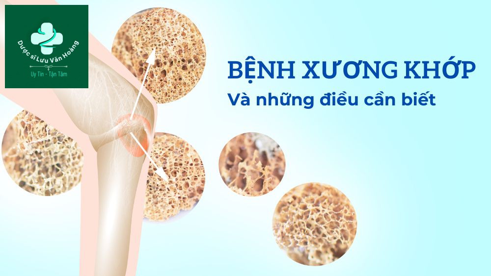 thuoc-bo-xuong-khop-1