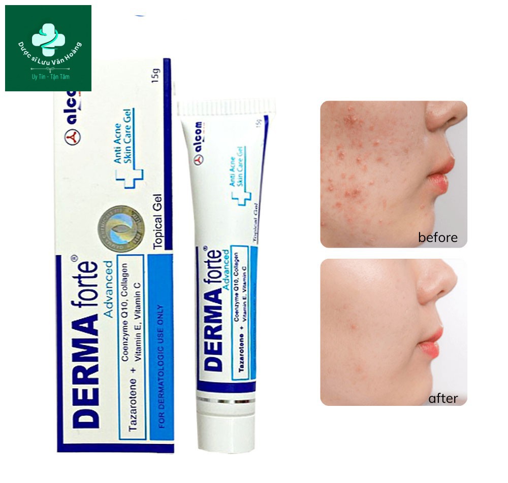 Đẩy lùi mụn với Derma Forte