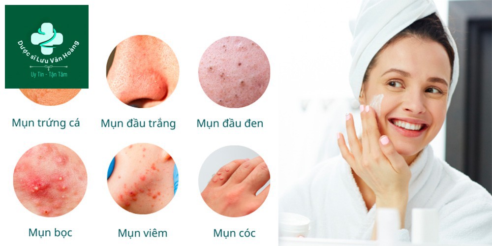 Các loại mụn trên da