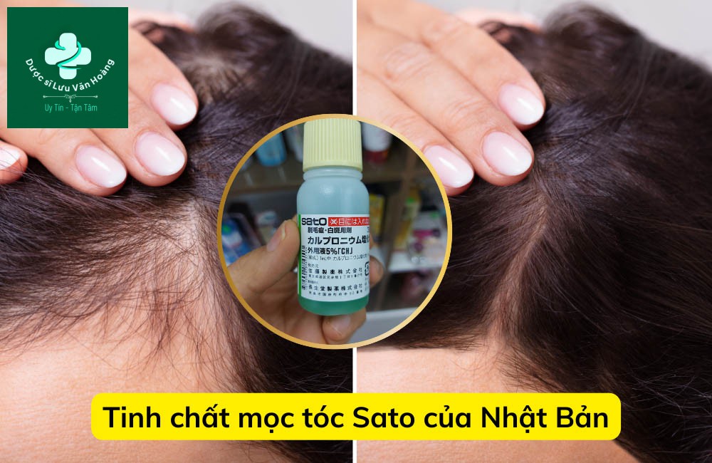 tinh chat moc toc sato cua nhat