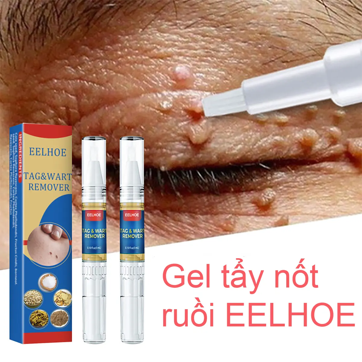 Gel tẩy nốt ruồi EELHOE