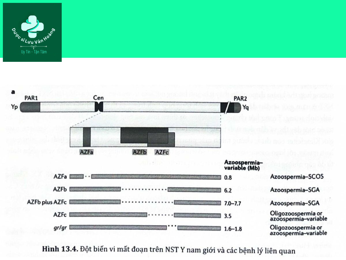 Rối loạn chức năng tình dục nam là gì? Nguyên nhân và các yếu tố nguy cơ 16 Hình 13.4. Đột biến vi mất đoạn trên NST Y nam giới và các bệnh lý liên quan