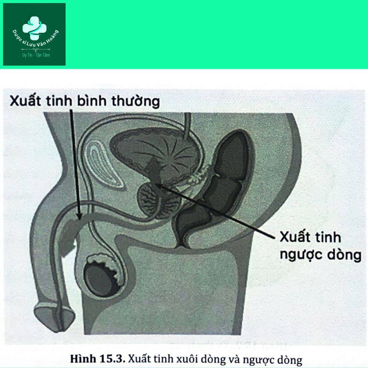 Hình 15.3. Xuất tỉnh xuôi dòng và ngược dòng