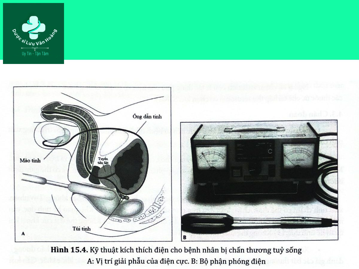Hình 15.4. Kỹ thuật kích thích điện cho bệnh nhân bị chấn thương tuỷ sốngA: Vị trí giải phẫu của điện cực. B: Bộ phận phóng điện