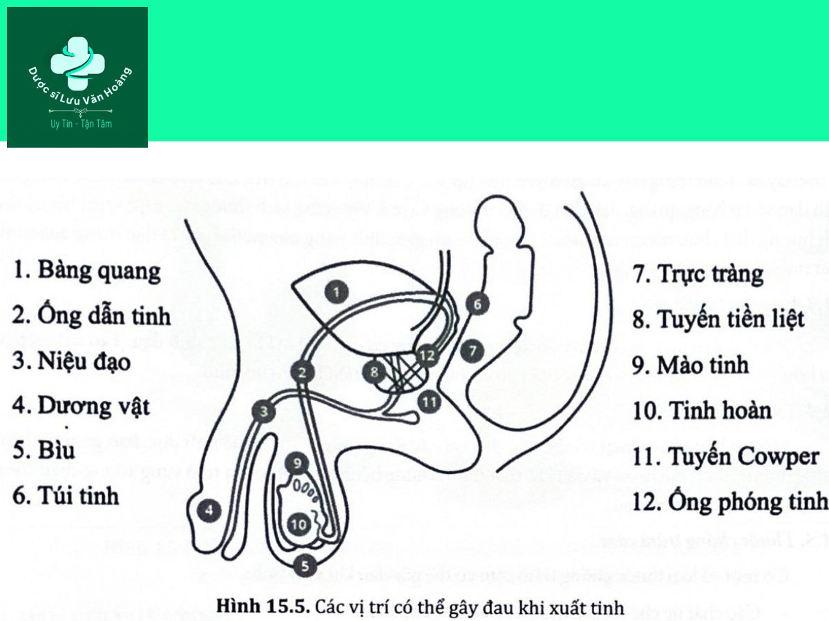Hình 15.5. Các vị trí có thể gây đau khi xuất tỉnh