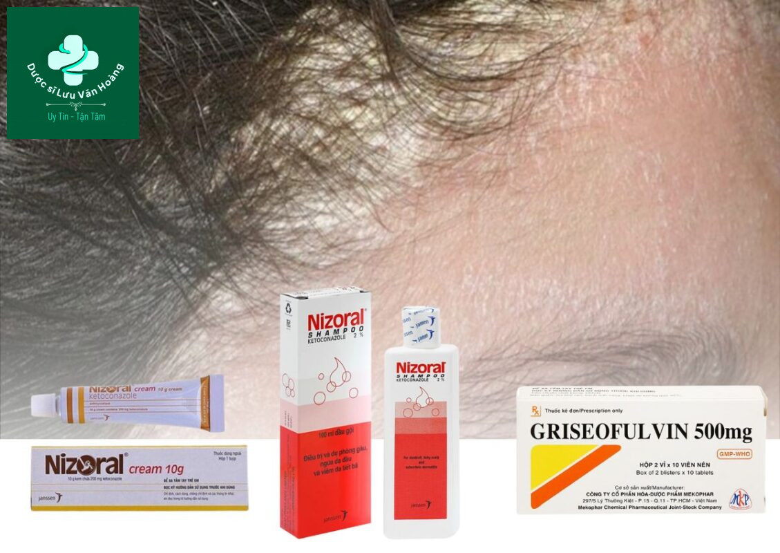 Thuốc điều trị nấm da đầu