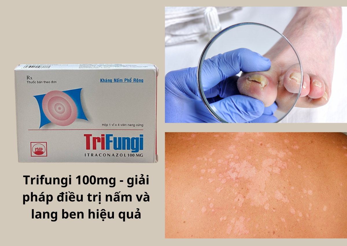 Trifungi 100mg