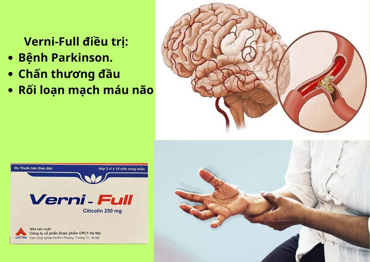 Verni-Full