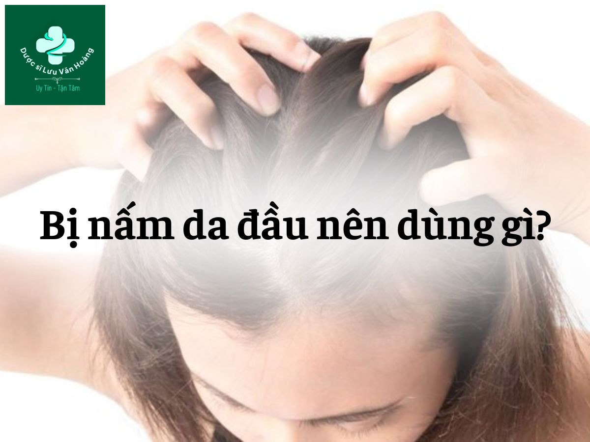 Bị nấm da đầu nên dùng gì?