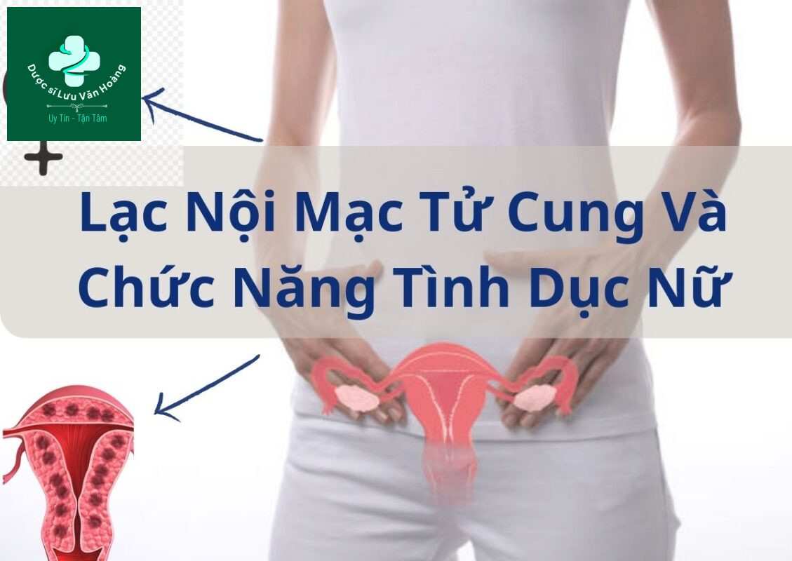 Lạc nội mạc tử cung là gì? Nguyên nhân và phương pháp điều trị