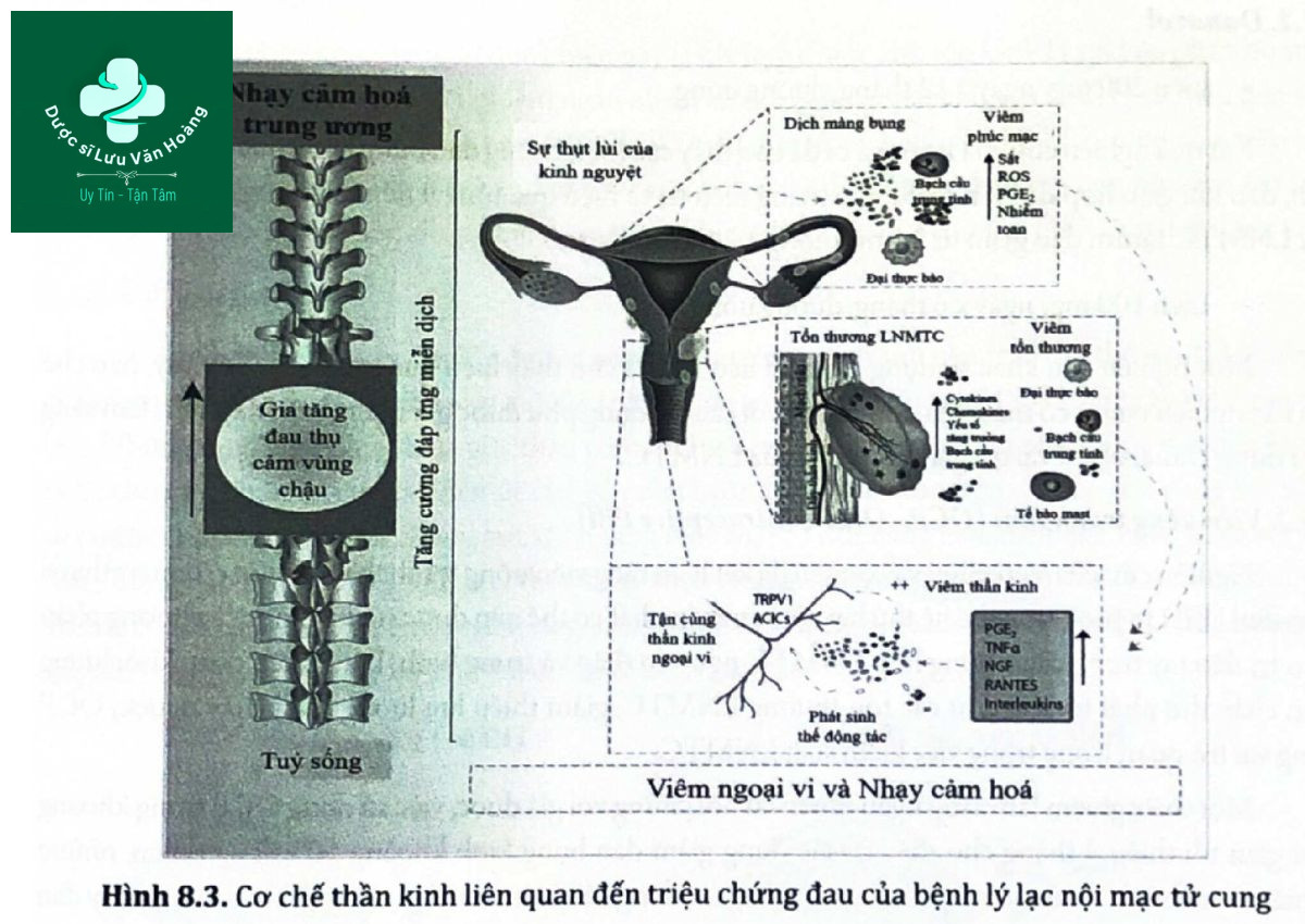 Cơ chế thần kinh liên quan đến triệu chứng đau của bệnh lý lạc nội mạc tử cung