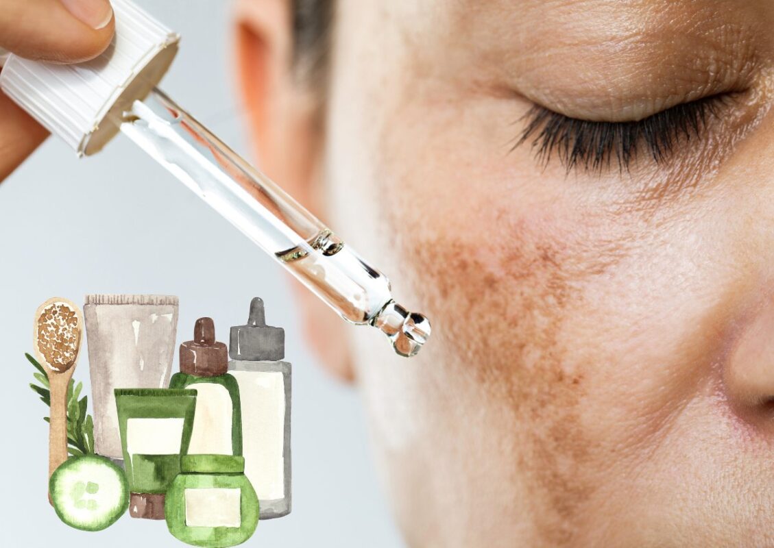 Nên lựa chọn thuốc trị nám da nào an toàn hiệu quả cao? 22 Thuốc trị nám