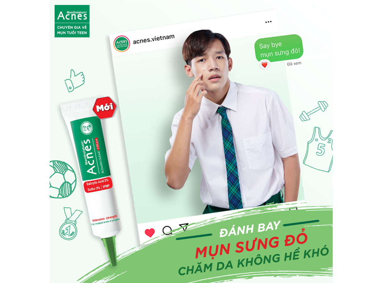 Acnes Blemish Clear Cream 10 Acnes Blemish Clear Cream