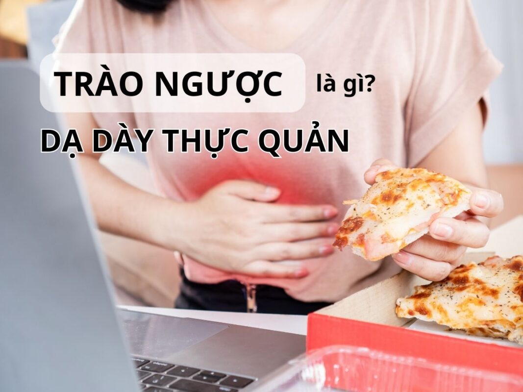 5+ thuốc đặc trị trào ngược dạ dày tốt nhất 18 Trào ngược dạ dày