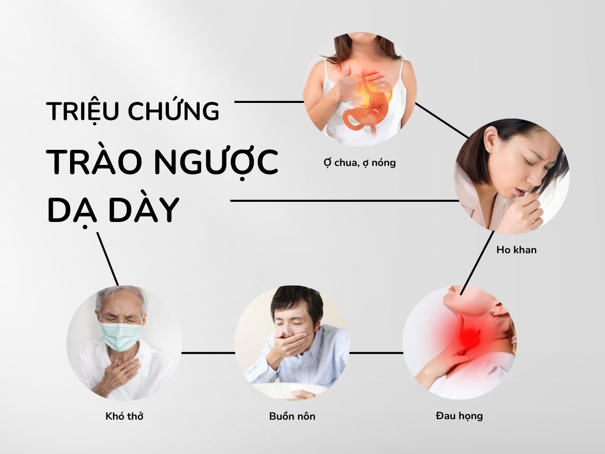 5+ thuốc đặc trị trào ngược dạ dày tốt nhất 21 Triệu chứng của trào ngược dạ dày