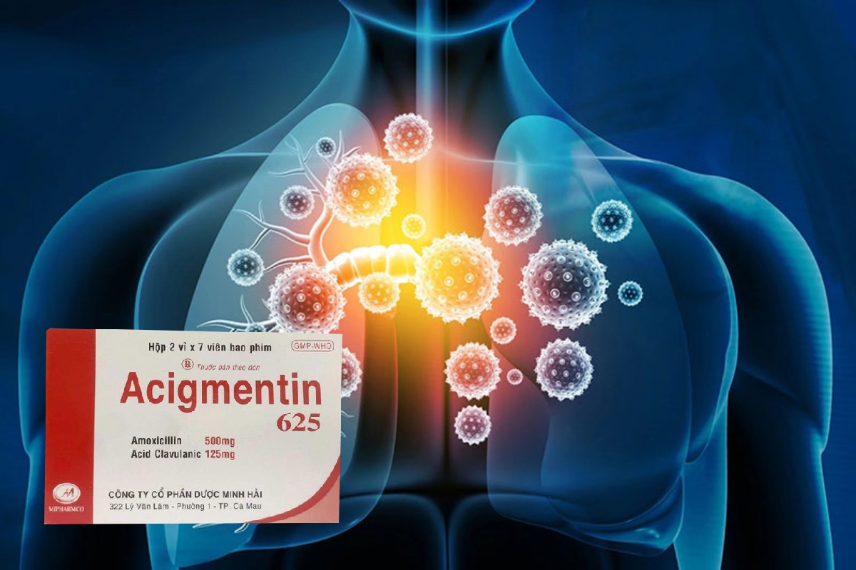 Acigmentin 625