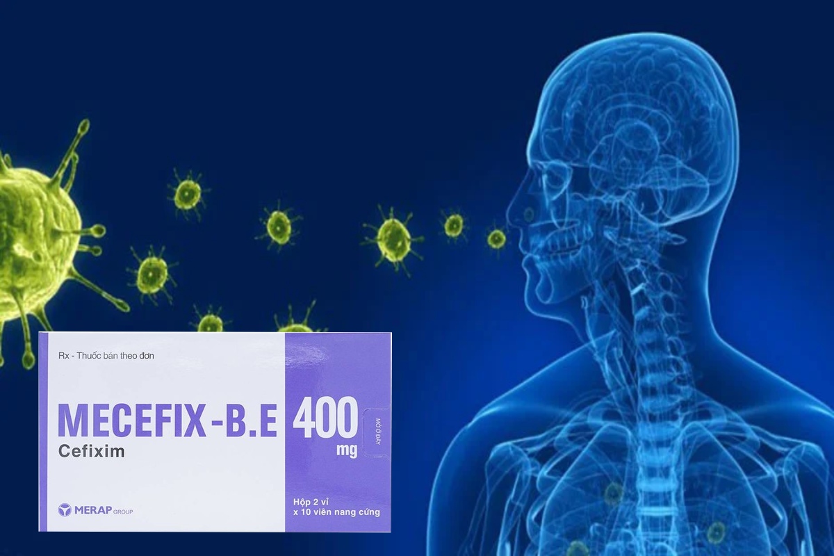 Mecefix - B.E 400mg 10 Mecefix - B.E 400mg