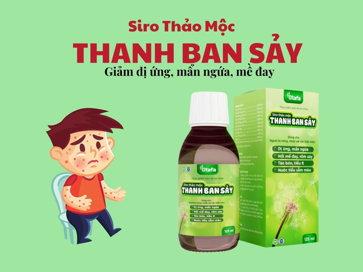 Siro Thảo Mộc Thanh Ban Sảy 13 Siro Thảo Mộc Thanh Ban Sảy - Giảm dị ứng, mề đay