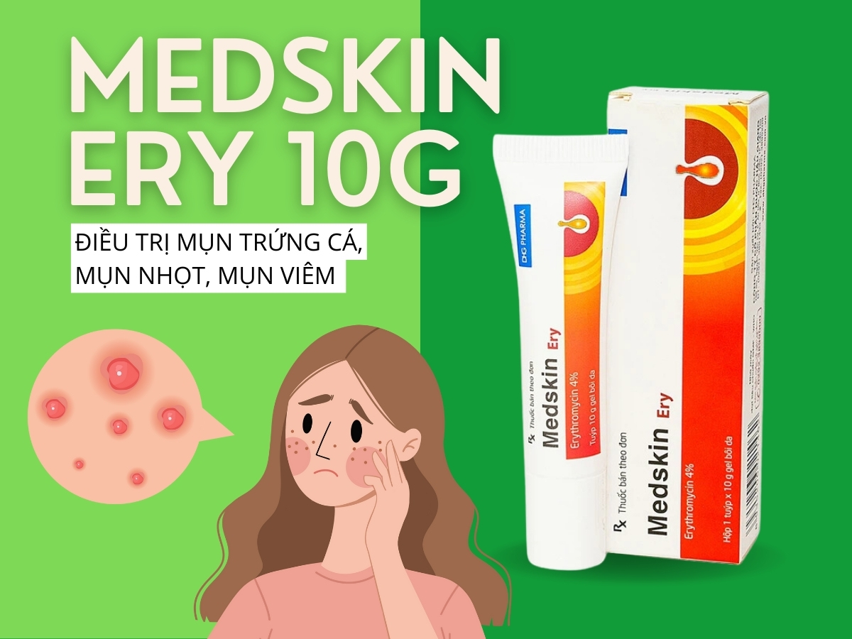 Thuốc Medskin Ery 10g điều trị mụn trứng cá, mụn viêm, mụn nhọt