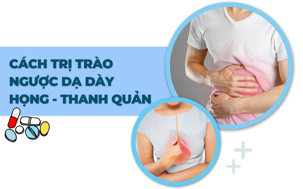 Cách trị trào ngược dạ dày họng-thanh quản hiệu quả