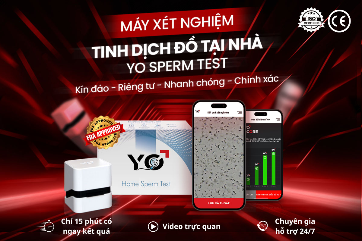  Máy xét nghiệm tinh dịch đồ tại nhà - YO SPERM TEST