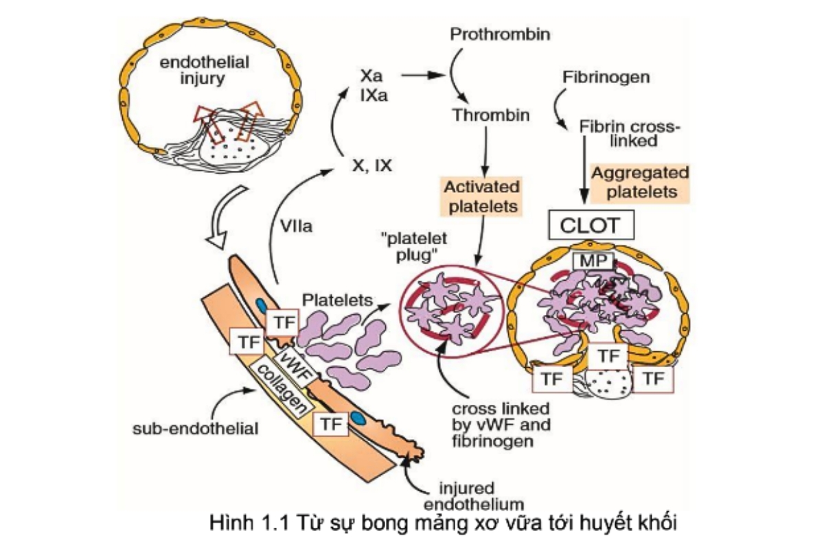 TÌM HIỂU VỀ CÁC NHÓM THUỐC CHỐNG ĐÔNG MÁU HIỆN NAY 8 Hình 1.1 Từ sự bong mảng xơ vữa tới huyết khối