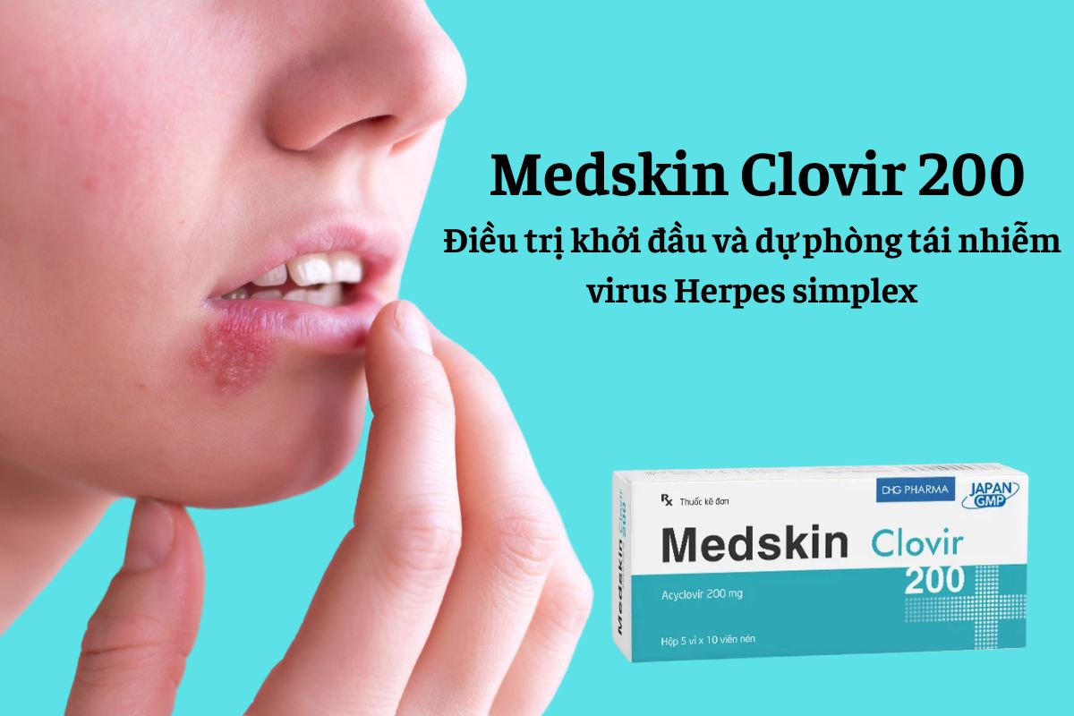 Thuốc Medskin Clovir 200 có tác dụng điều trị khởi đầu và dự phòng tái nhiễm virus Herpes simplex