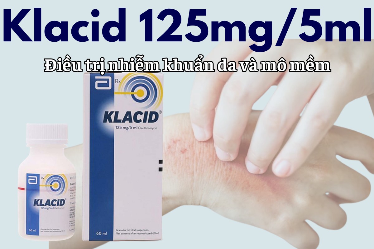 Klacid 125mg/5ml điều trị nhiễm khuẩn da và mô mềm