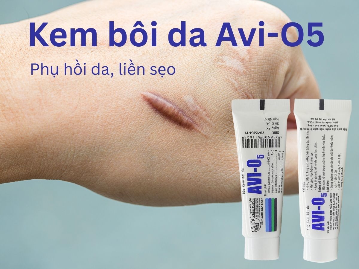Kem bôi da Avi-O5