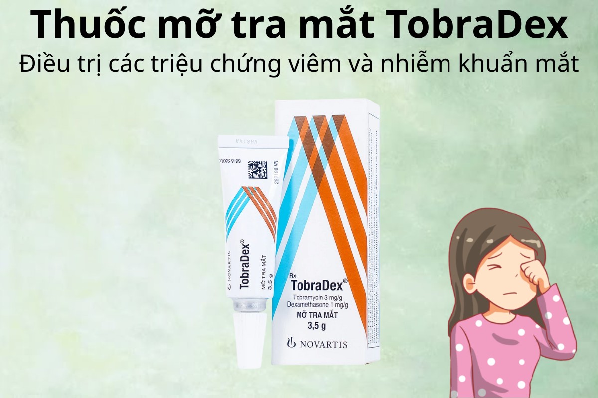 Thuốc mỡ tra mắt TobraDex 13 Thuốc mỡ tra mắt TobraDex điều trị triệu chứng viêm và nhiễm khuẩn mắt