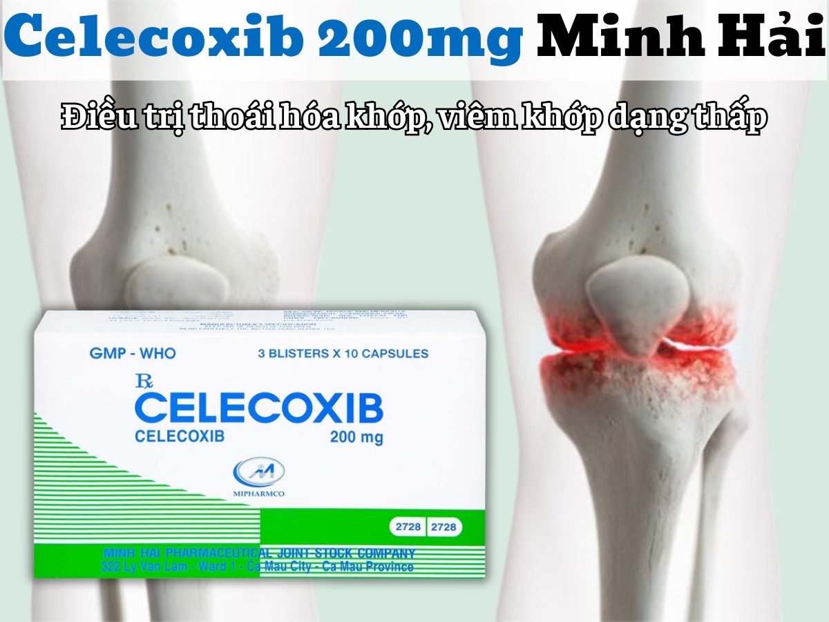 Celecoxib 200mg Minh Hải 11 Celecoxib 200mg Minh Hải điều trị thoái hóa khớp, viêm khớp dạng thấp