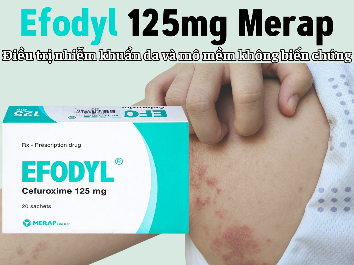 Efodyl 125mg Merap 8 Efodyl 125mg Merap điều trị nhiễm khuẩn da và mô mềm không biến chứng
