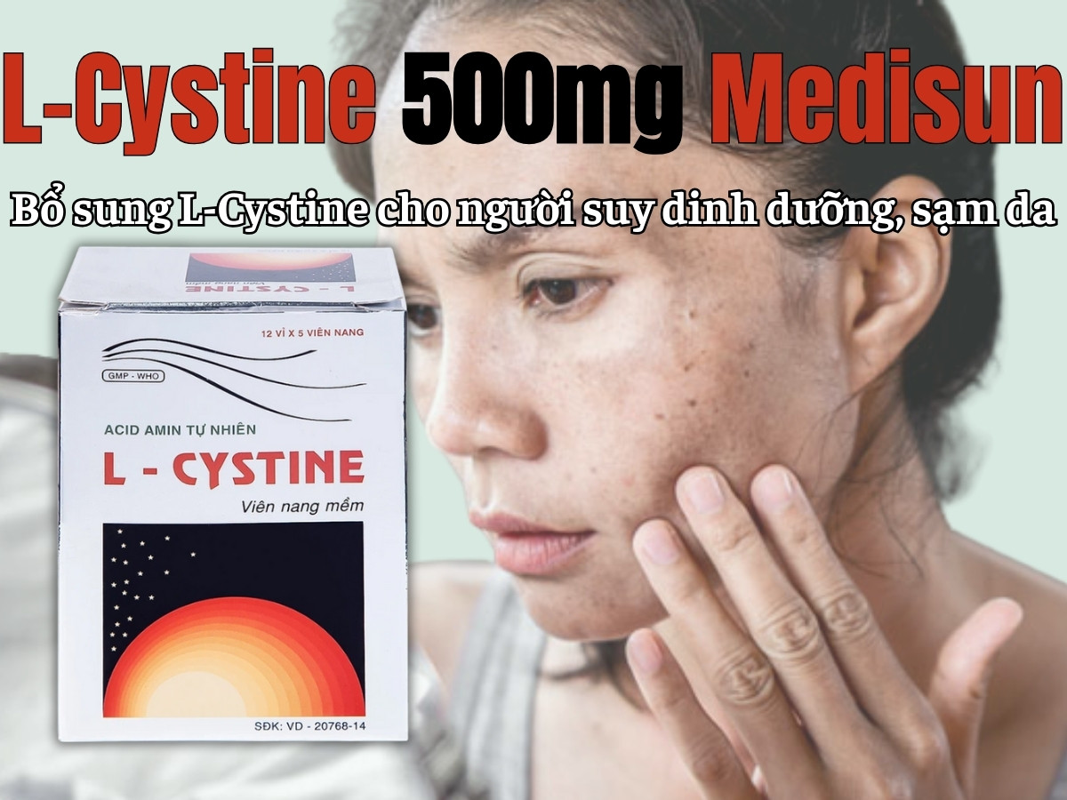 L-Cystine 500mg Medisun bổ sung cho người suy dinh dưỡng, kém hấp thu, sạm da