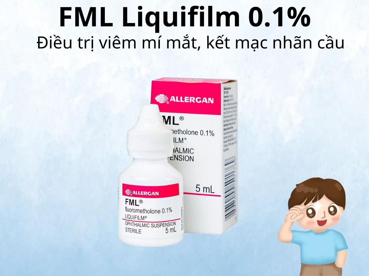 FML Liquifilm 0.1% 10 FML Liquifilm 0.1% điều trị viêm mí mắt, kết mạc nhãn cầu