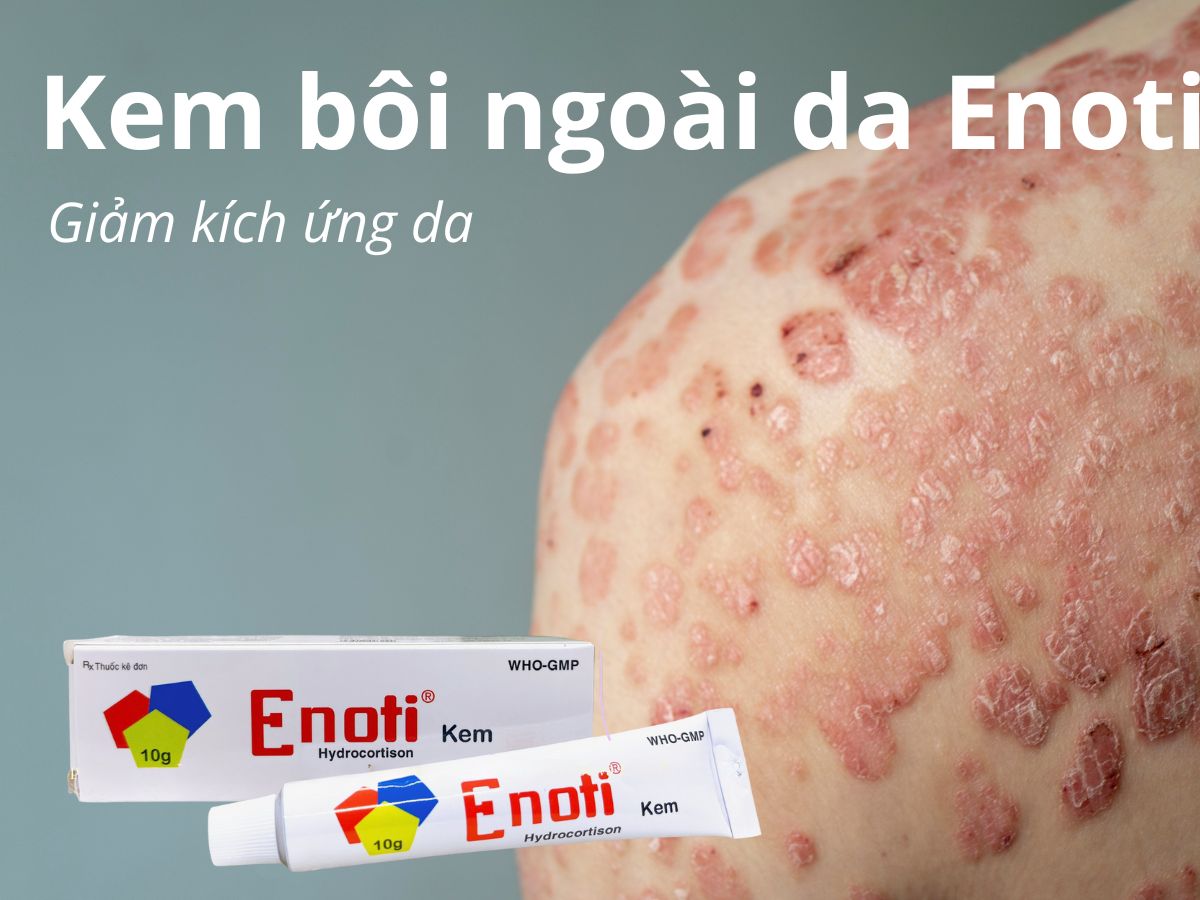 Kem bôi ngoài da Enoti 16 Kem bôi ngoài da Enoti