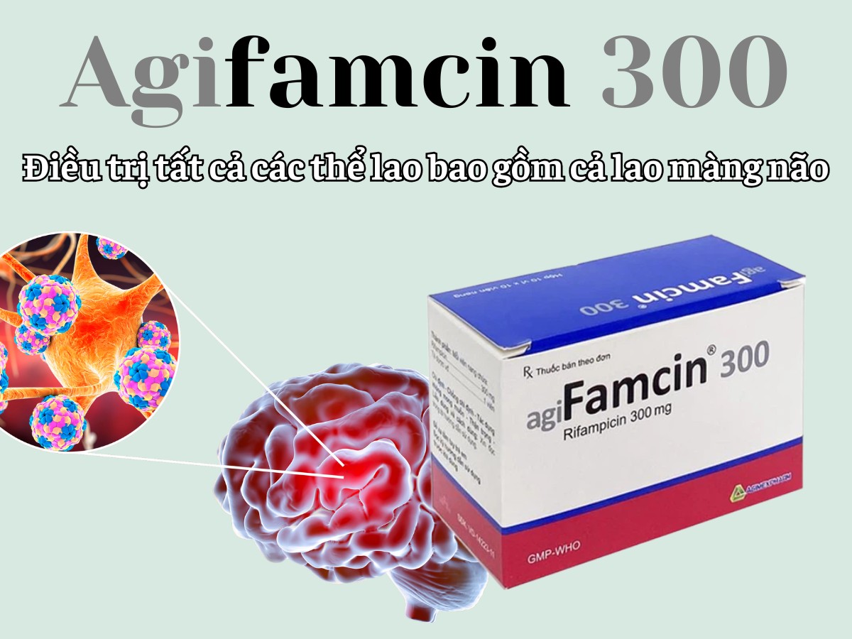 Agifamcin 300 6 Agifamcin 300 điều trị lao màng não