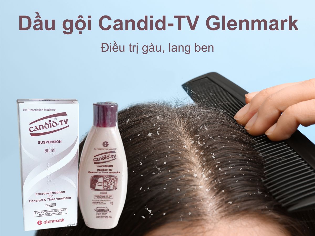 Dầu gội Candid-TV Glenmark