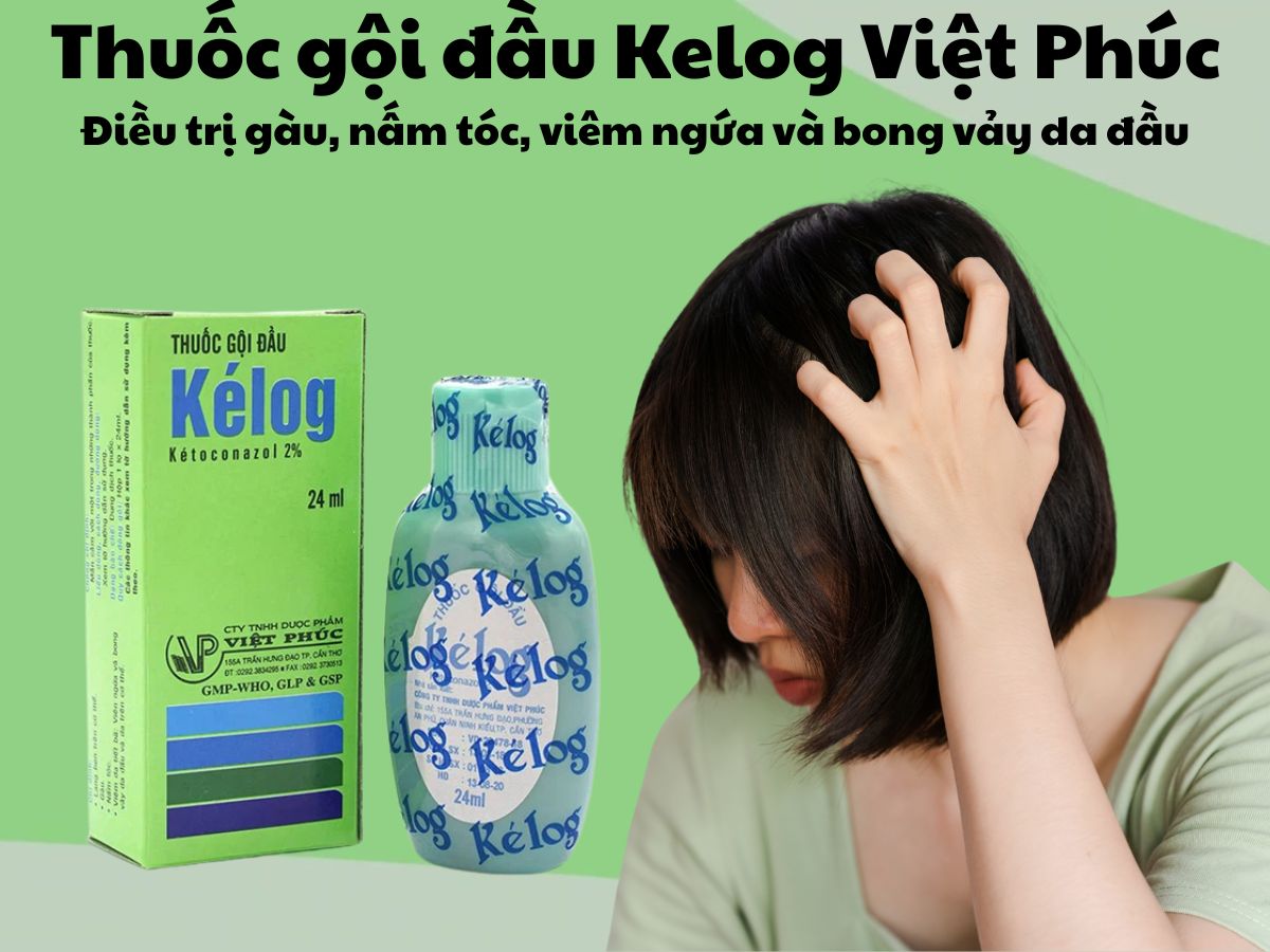 Thuốc gội đầu Kélog 24ml - điều trị gàu, nấm tóc, viêm ngứa và bong vảy da đầu