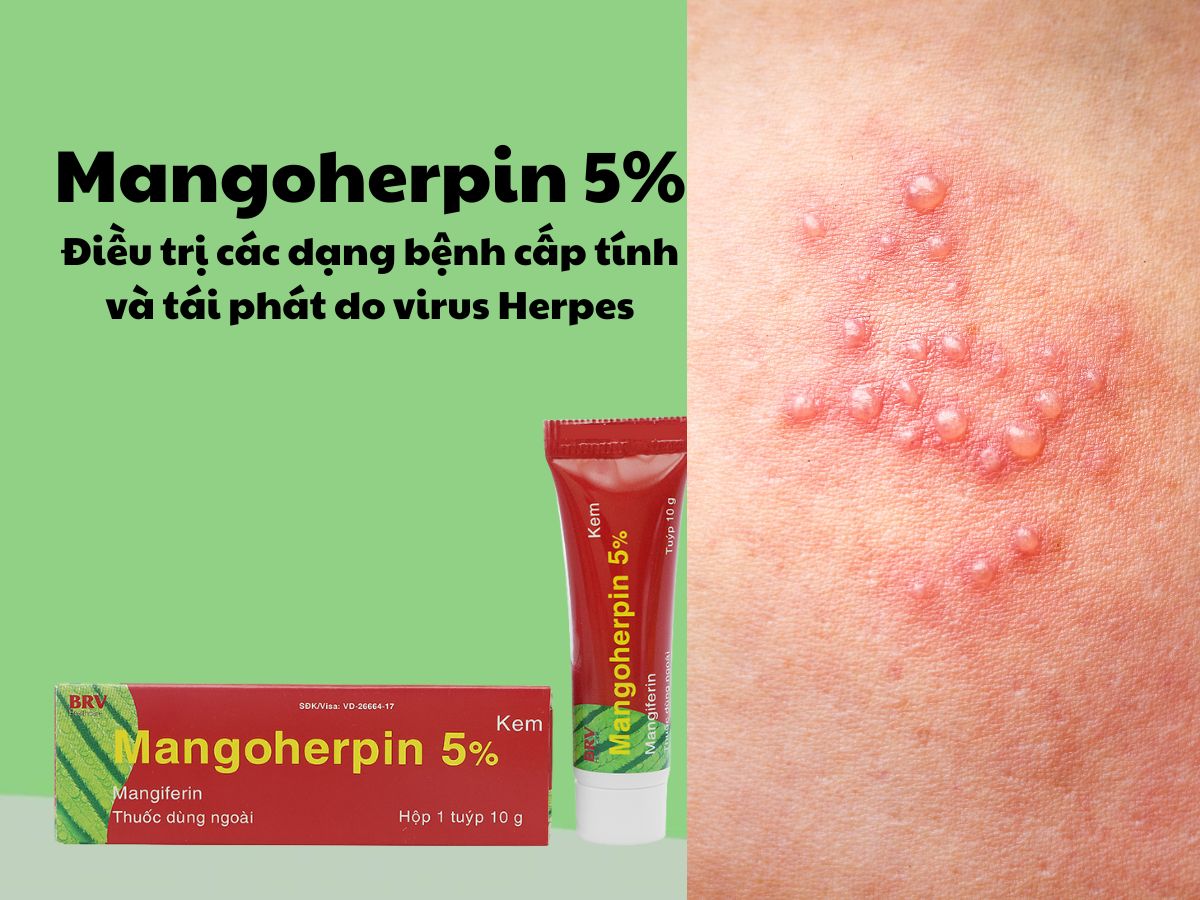 Thuốc Mangoherpin 5% - điều trị các bệnh lý do virus herpes gây ra