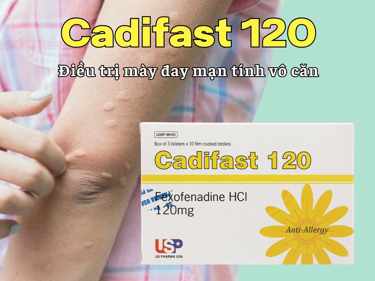 Cadifast 120 điều trị mày đay mạn tính vô căn