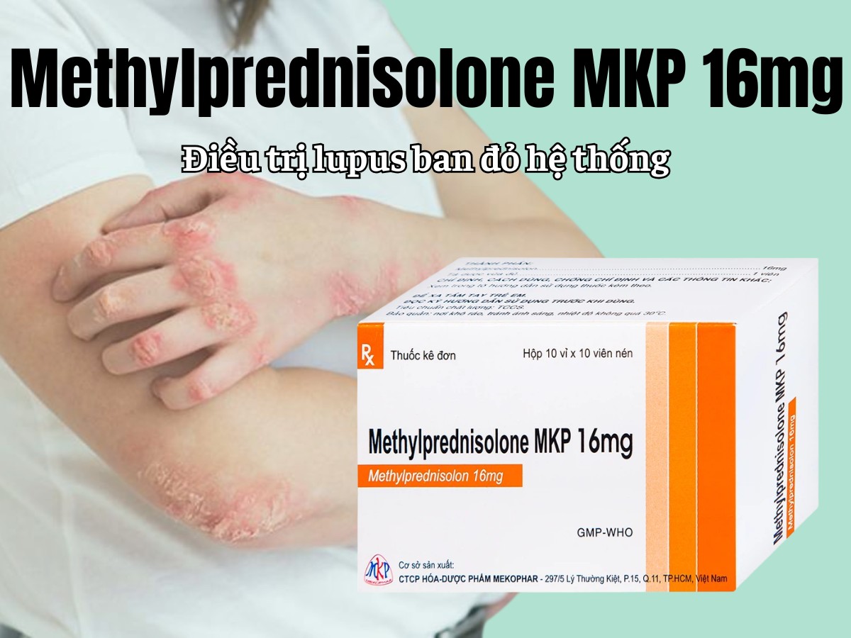 Methylprednisolone MKP 16mg 11 Methylprednisolone MKP 16mg điều trị lupus ban đỏ hệ thống