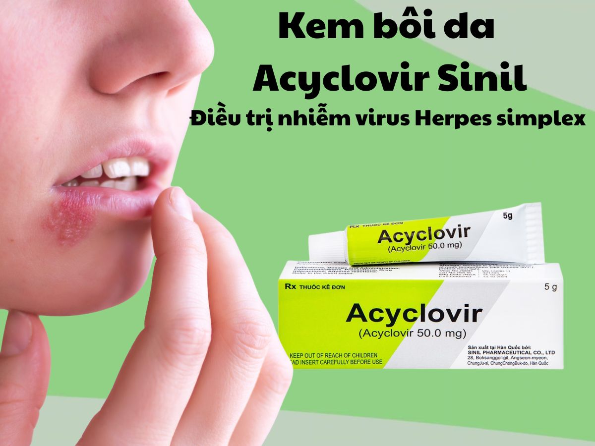 Kem bôi da Acyclovir Sinil 12 Kem bôi da Acyclovir Sinil giúp điều trị herpes simplex môi và sinh dục